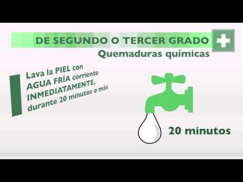 Como tratar quemaduras