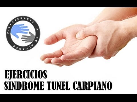 Ejercicios para aliviar el sindrome del tunel carpiano