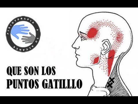 ¿Que són las contracturas musculares?