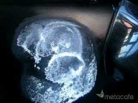 Como quitar un golpe del coche 