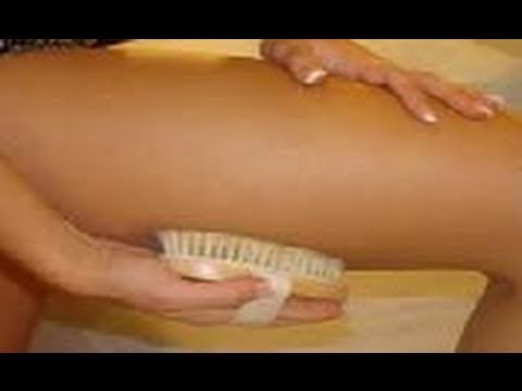 Consejos para venas, varices y varicosas