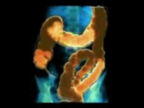 Limpiar el intestino