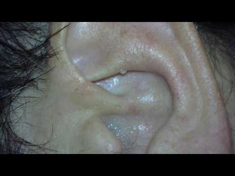 Remedio contra la gripe