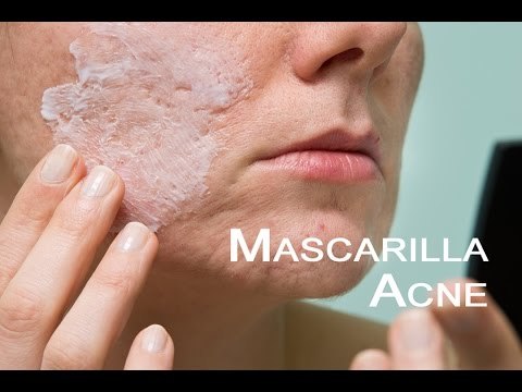Mascarilla para eliminar granos y acné