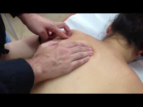 Acupuntura - Tratamiento del dolor de espalda