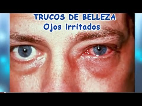 Tratamiento de ojos irritados