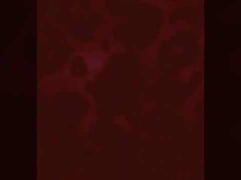 ¿Que es un pleonasmo? Y algunos ejemplos