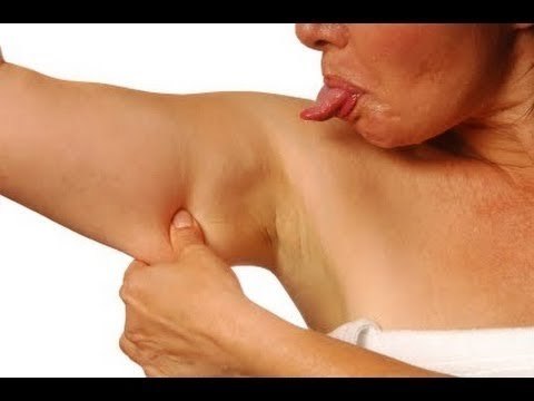 Cómo mejorar los brazos gordos y caídos