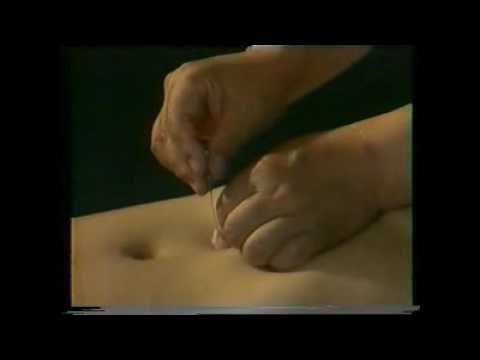 Acupuntura técnicas básicas I